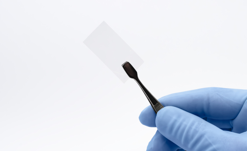 Why Amniotic Skin Grafts Are Leading the Next Generation of Skin Substitutes