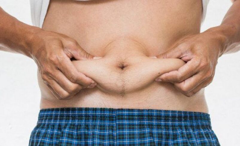 Benefits of Tummy Tuck Surgery in Islamabad for Post-Pregnancy Bodies